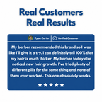 Advanced Hair Growth Roll-on Serum