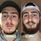 Advanced Beard Growth Roll-on Serum