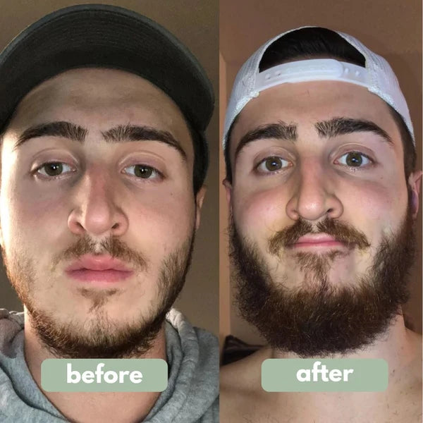 Advanced Beard Growth Roll-on Serum