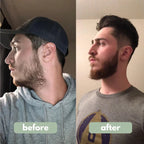 Advanced Beard Growth Roll-on Serum