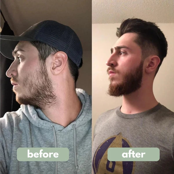 Advanced Beard Growth Roll-on Serum