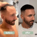 Advanced Hair Growth Roll-on Serum